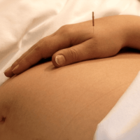 Hamilelikte Akupunktur Yapılabilir mi?