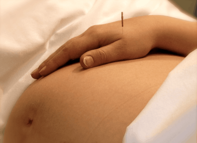 Hamilelikte Akupunktur Yapılabilir mi?